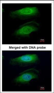 RICTOR antibody