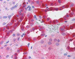 Goat anti-RICTOR Antibody