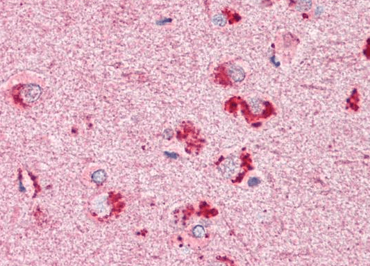 Goat anti-RIF1 (aa 2076-2089) Antibody