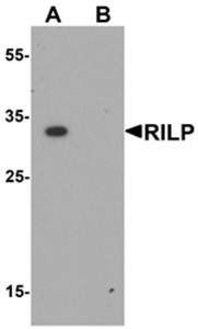 RILP Antibody