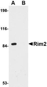 Rim2 Antibody