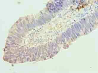 RINT1 antibody