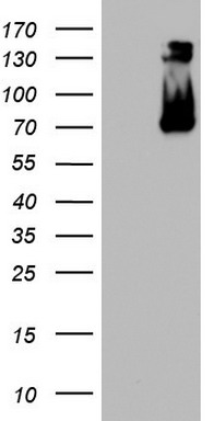 RIP (RIPK1) antibody