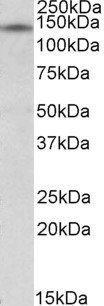 Goat anti-RIP140 Antibody