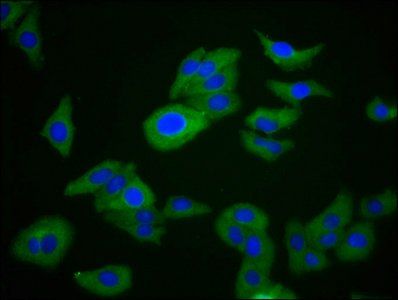 RIPK1 Antibody