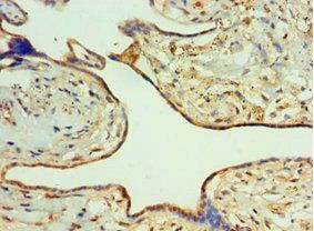 RIPK2 Antibody