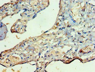 RIPK3 Antibody