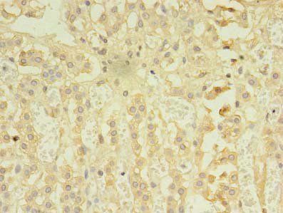 RIPK3 Antibody