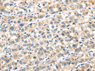 RIPK4 Antibody