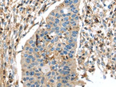 RIPK4 Antibody