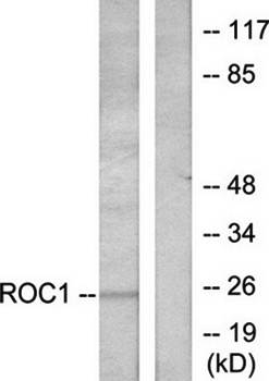RIT1 antibody