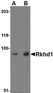 Rkhd1 Antibody