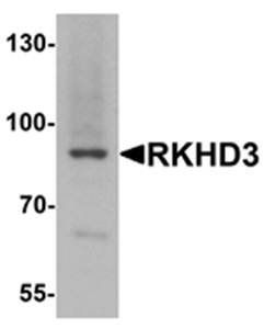 RKHD3 Antibody