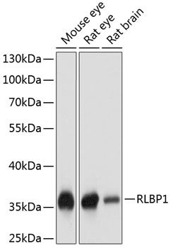 RLBP1 antibody