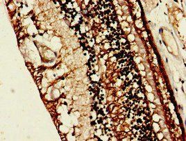 RLBP1 Antibody