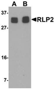 RLP2 Antibody