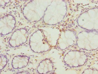 RMDN1 Antibody