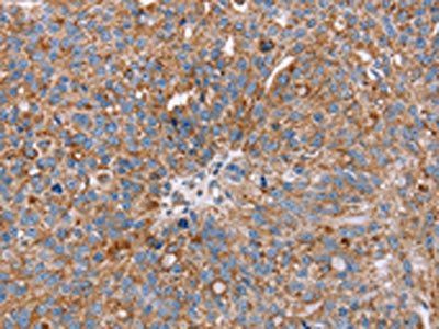 RMDN3 Antibody