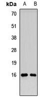 RMI2 antibody