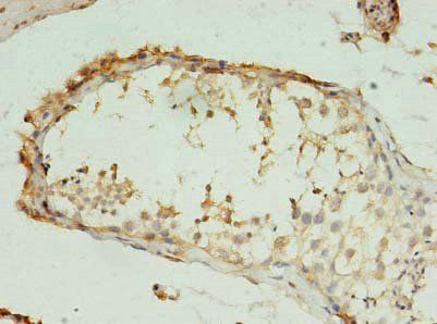 RMND5B antibody