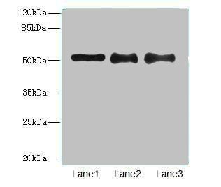 RBMY1A1 Antibody