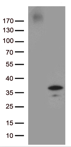 RNA5-8SN2 antibody