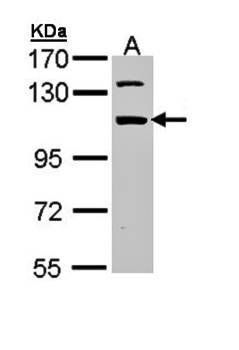 RNA binding motif protein 28 antibody