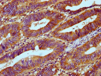 RNASEH1 Antibody