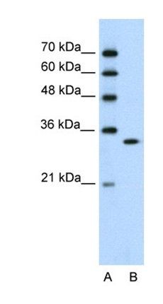 RNASEH2A antibody