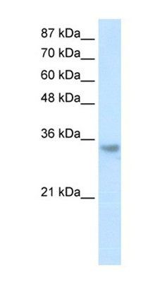 RNASEH2A antibody