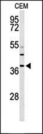 RNASEH2B antibody