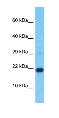 RNASEH2C antibody