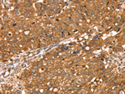RNASET2 Antibody