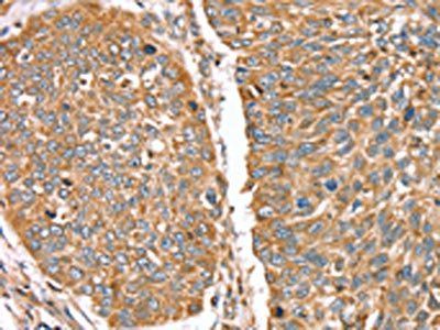 RNF11 antibody