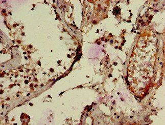 RNF126 Antibody