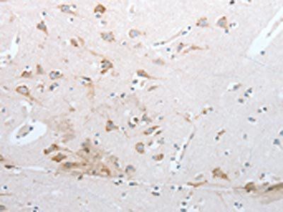 RNF126 Antibody