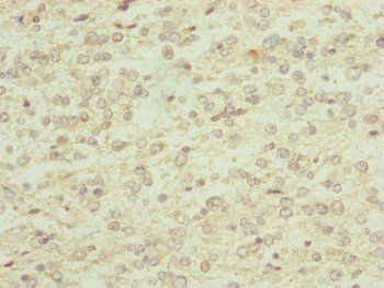 RNF13 antibody