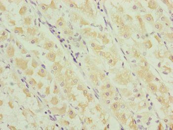 RNF135 Antibody