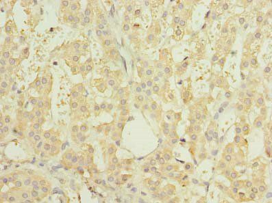 RNF138 Antibody