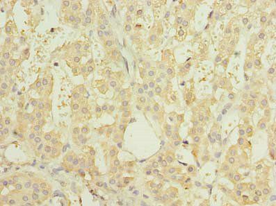 RNF138 antibody