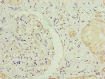 RNF139 Antibody