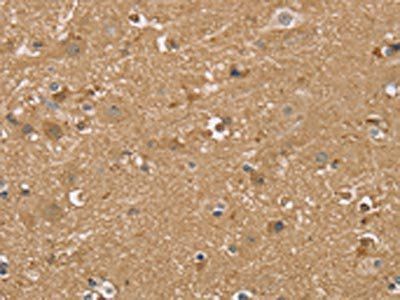 RNF139 Antibody