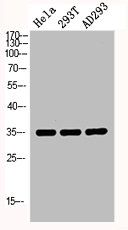 RNF144B antibody