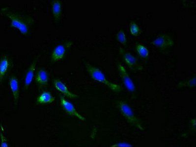 RNF148 antibody