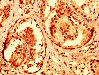 RNF168 Antibody