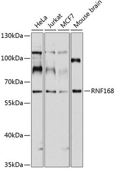RNF168 antibody