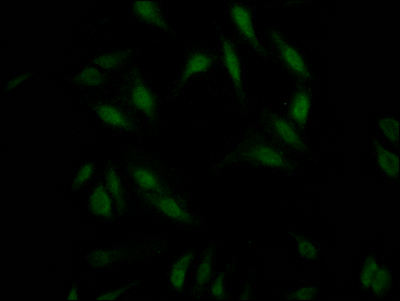 RNF20 Recombinant Monoclonal Antibody