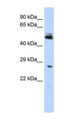 RNF212 antibody