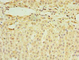 RNF212 Antibody