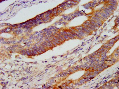 RNF213 Antibody